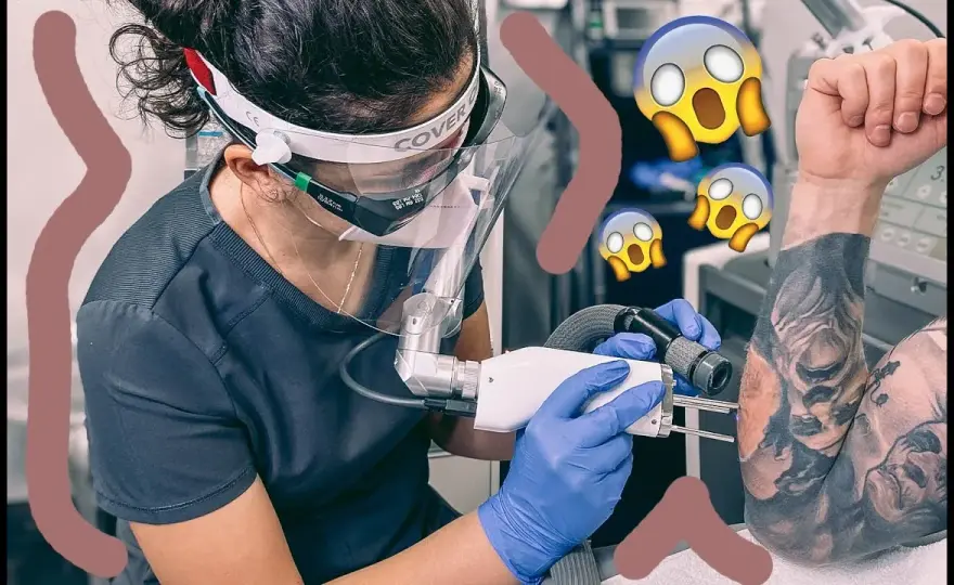 Jak wygląda usunięty tatuaż? Efekty i proces laserowego usuwania