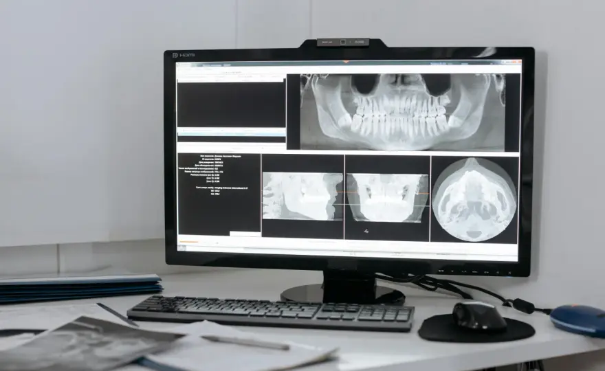 Teleradiologia – jakie korzyści daje placówkom medycznym?