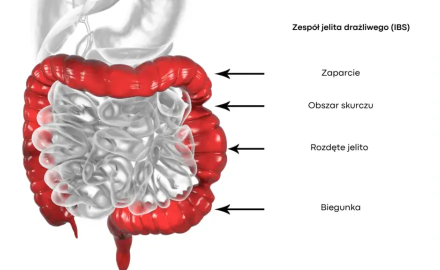 Zespół jelita drażliwego: jakie badania są kluczowe dla diagnozy?