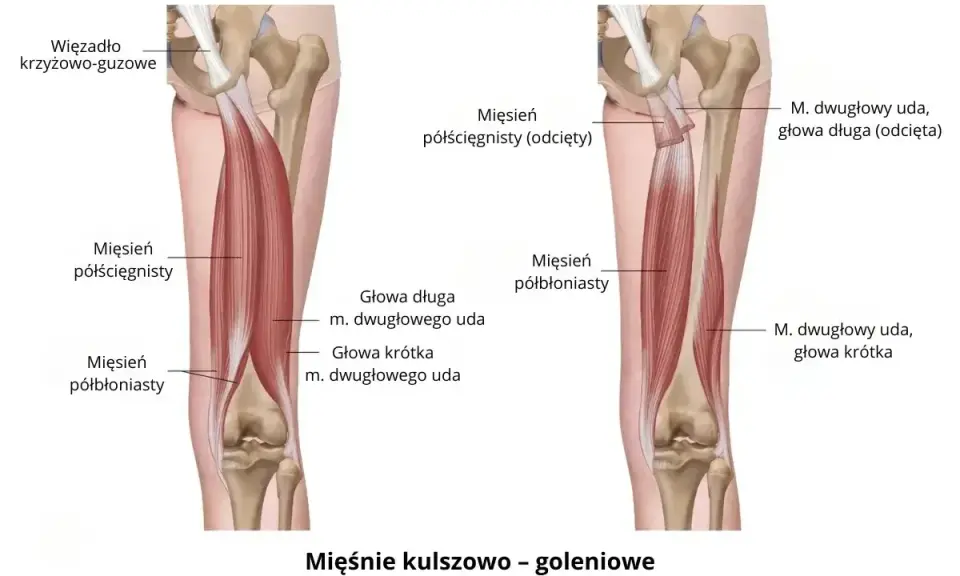 Anatomia mięśni kulszowo-goleniowych, które mogą powodować ból mięśni. Widoczne więzadło krzyżowo-guzowe i mięśnie: półścięgnisty i półbłoniasty.