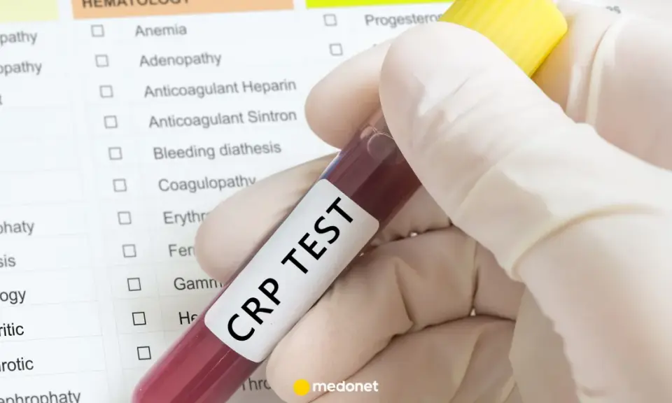 Ręka w rękawiczce trzyma probówkę z krwią z napisem "CRP TEST" na tle listy badań.
