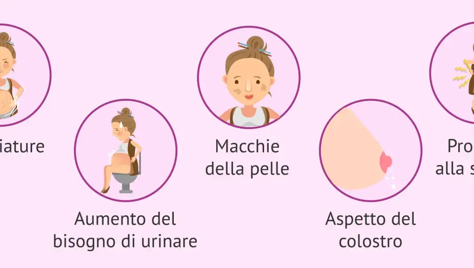 Il sesto mese di gravidanza porta smagliature, macchie sulla pelle, aumento del bisogno di urinare, colostro e problemi alla schiena.