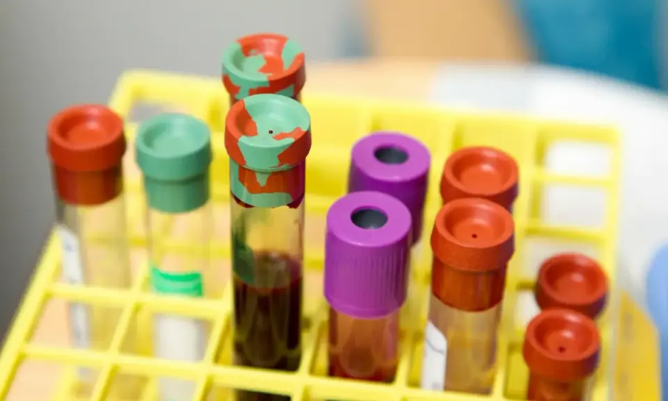 Probówki z krwią w żółtym stojaku laboratoryjnym.