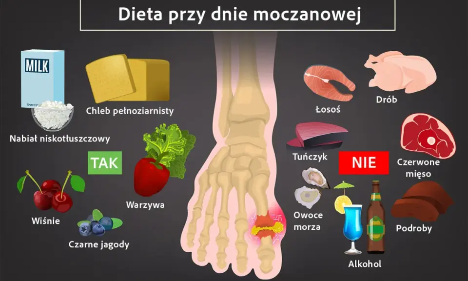 Dieta przy dnie moczanowej: TAK - nabiał, chleb, warzywa, wiśnie, jagody. NIE - drób, łosoś, tuńczyk, czerwone mięso, podroby, owoce morza, alkohol.