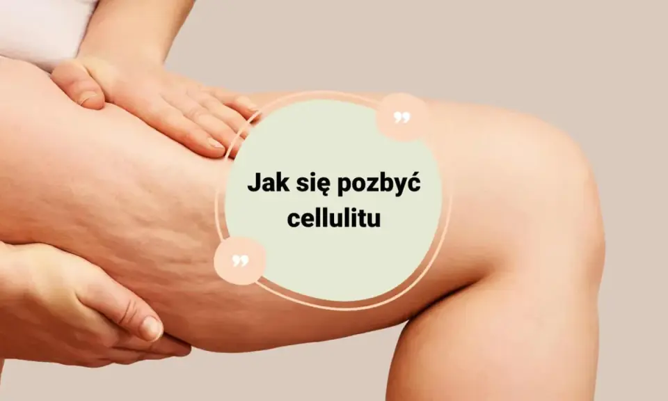 Jak pozbyłam się cellulitu? Mój 4-filarowy plan, który działa!