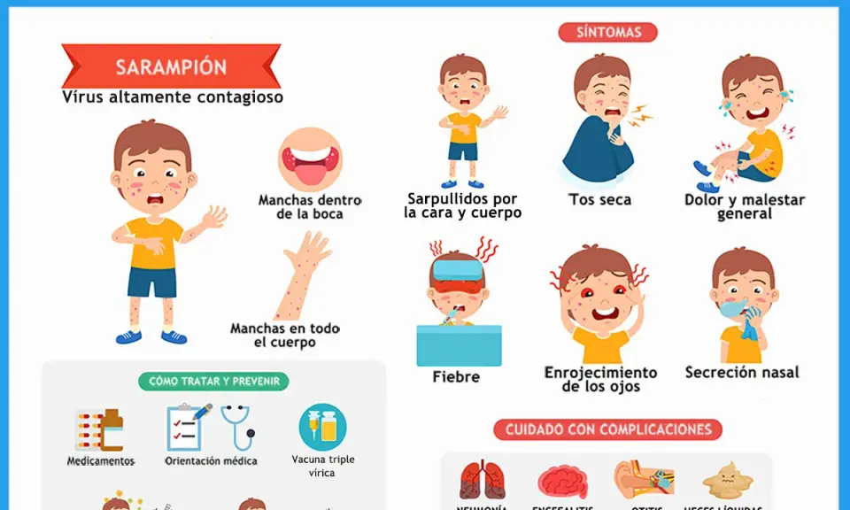 Ilustración sobre el brote de sarampión en niños, mostrando síntomas como sarpullidos, tos, fiebre y complicaciones.