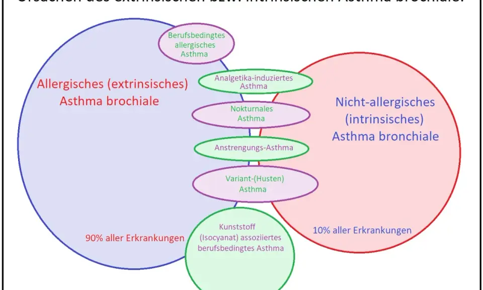 Schema zeigt extrinsisches Asthma, das 90% der Fälle ausmacht, mit Unterformen wie berufsbedingtem allergischem Asthma.