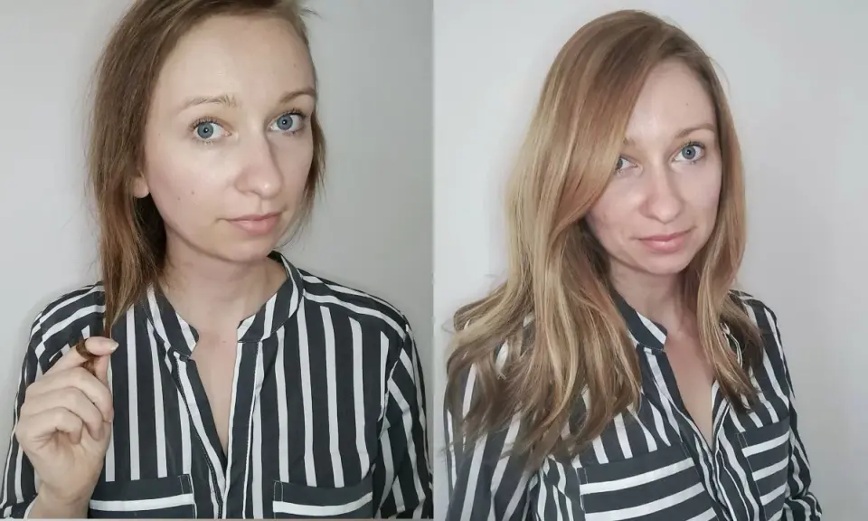Vorher/Nachher-Vergleich: Frau mit dünnem Haar und dann vollerem, glänzenderem Haar. Hilft wirklich bei Haarausfall bei Frauen.
