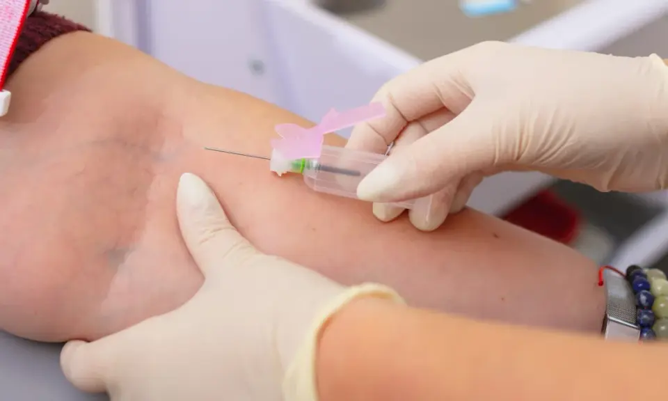 Pobieranie krwi do badania, które może wykazać, czy limfocyty podwyższone u dorosłego wymagają dalszej diagnostyki.