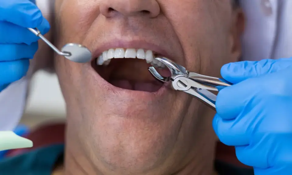 Ból po wyrwaniu zęba: ile trwa, co normą i kiedy do dentysty?