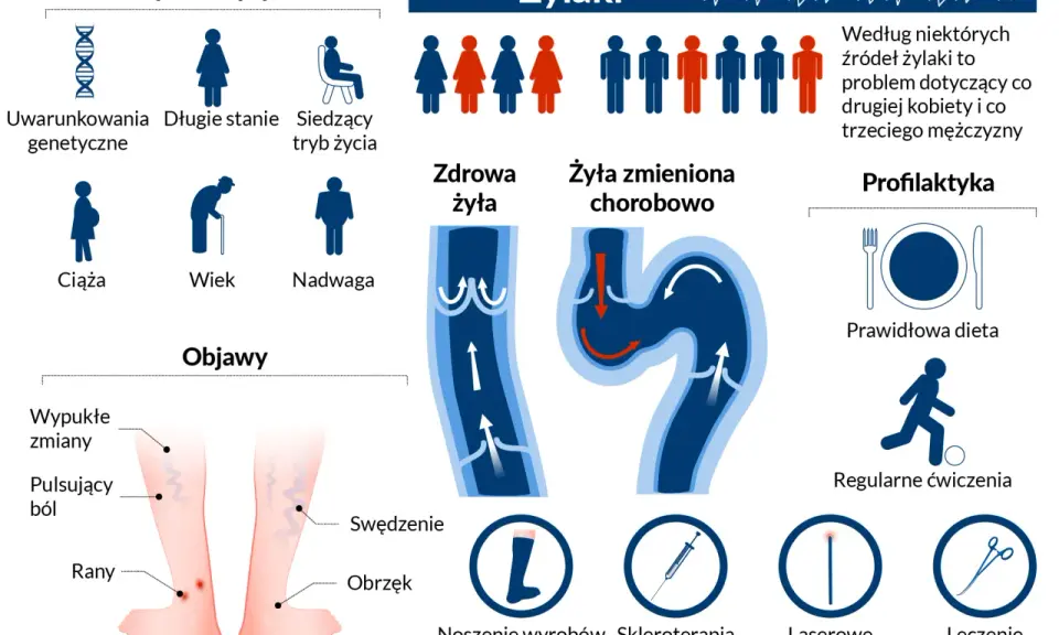 Jak dbać o żyły? Infografika przedstawia czynniki ryzyka żylaków, objawy, zdrową i chorą żyłę, a także profilaktykę: dietę, ćwiczenia, wyroby kompresyjne i metody leczenia.