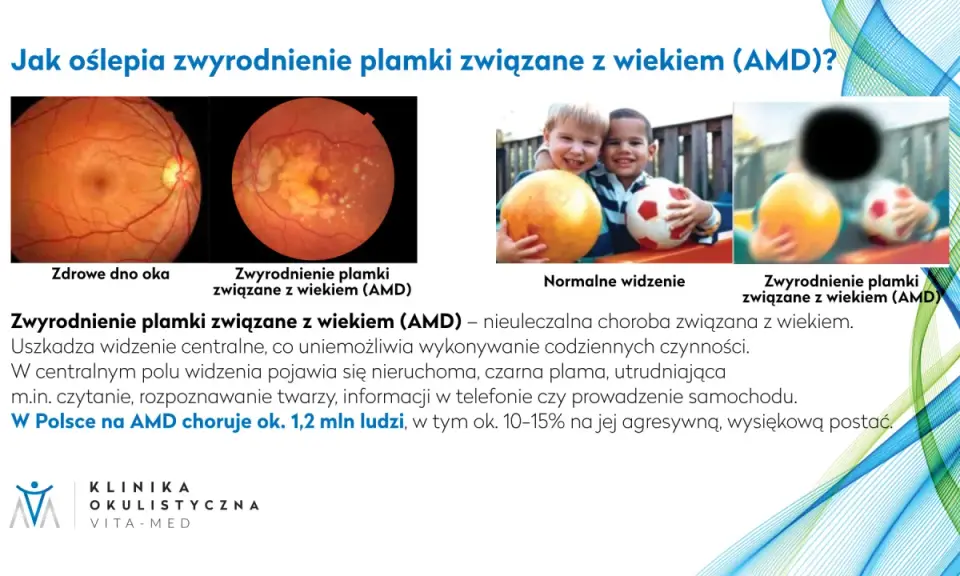Badanie dna oka co wykrywa: zdrowe oko vs. zwyrodnienie plamki związane z wiekiem (AMD), wpływające na widzenie.