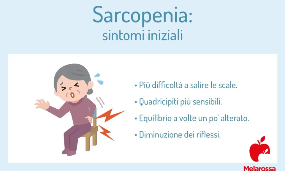 Anziana con difficoltà a sedersi, sintomi iniziali di sarcopenia: fatica a salire le scale, quadricipiti sensibili, equilibrio alterato, riflessi diminuiti.