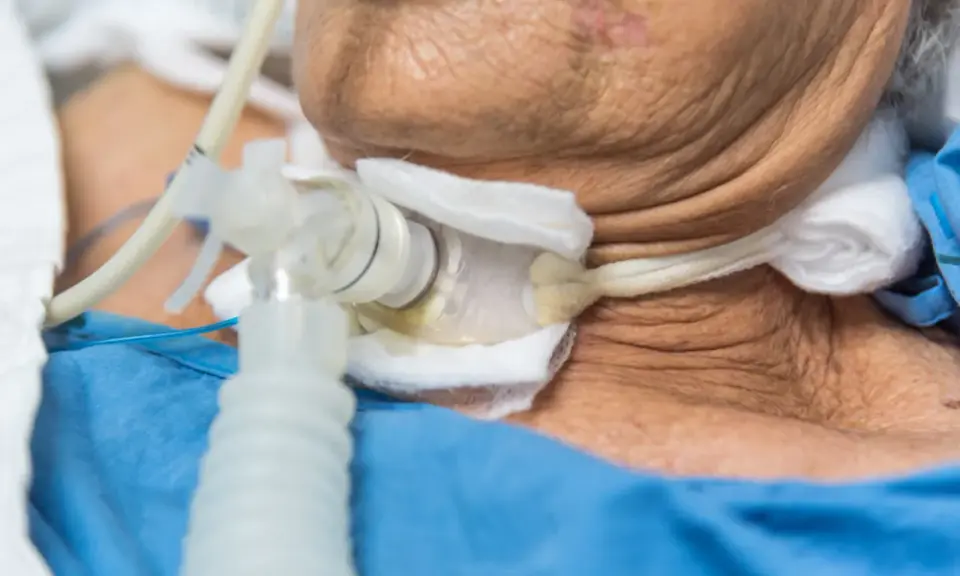 Zbliżenie na rurkę tracheostomijną u pacjenta w niebieskiej koszuli.