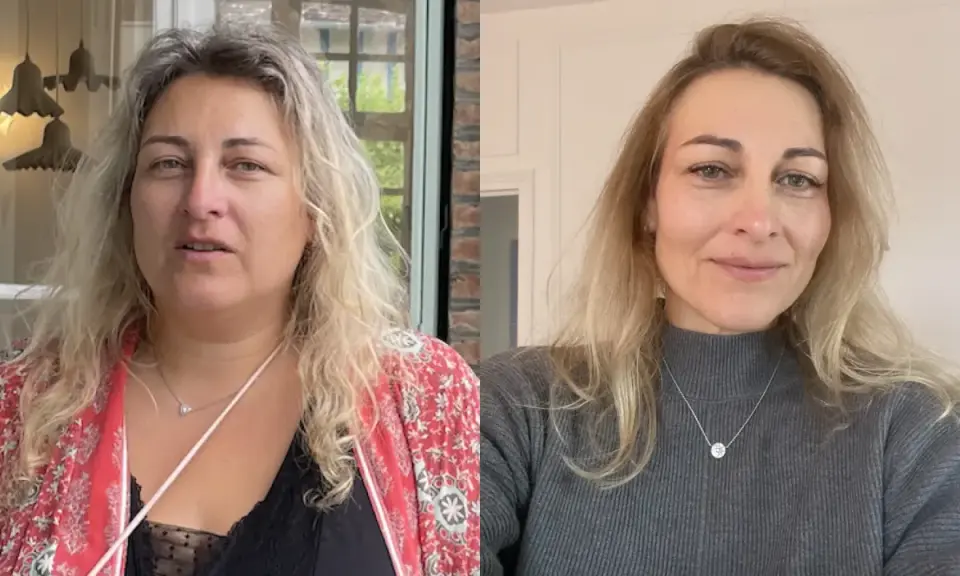 Avant/après : le visage s'affine visiblement après une perte de poids. La question "à partir de combien de kilos perd on du visage" trouve ici une réponse visuelle.