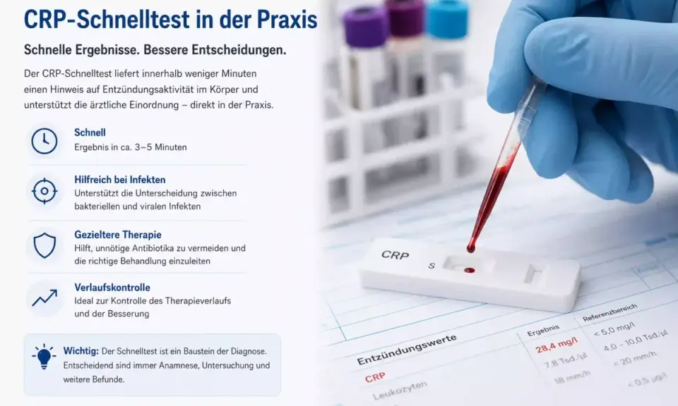 Blutstropfen fallen auf CRP-Testkassette. Ein hoher CRP-Wert im Blut zeigt Entzündungen an. Schnelle Ergebnisse für bessere Entscheidungen.