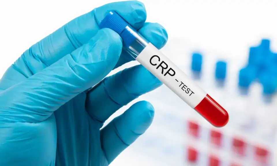 Ręka w niebieskiej rękawiczce trzyma probówkę z napisem "CRP - TEST". Badanie CRP pomaga ocenić stan zapalny w organizmie.