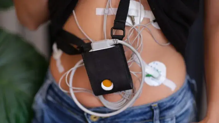 Holter EKG a nerwica: Co naprawdę mówi o Twoim sercu?