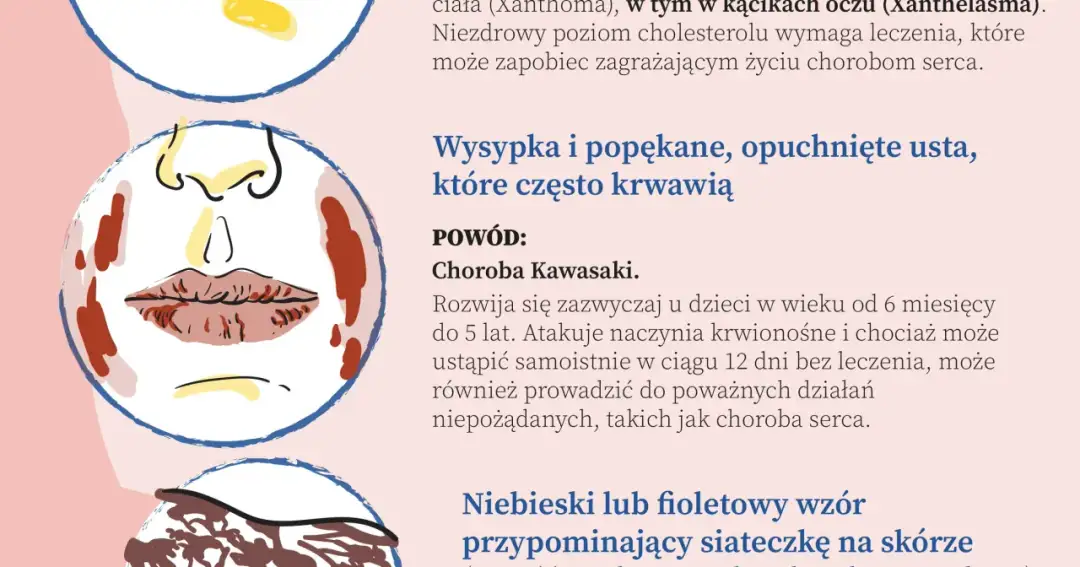 Najczęstsze choroby serca w Polsce - co musisz wiedzieć?