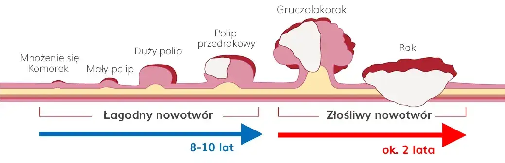 Stolec przy raku jelita grubego: kluczowe zmiany i objawy