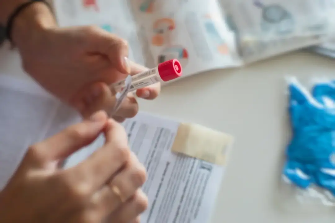 SHBG kiedy badać: najlepszy czas na test i jak się przygotować