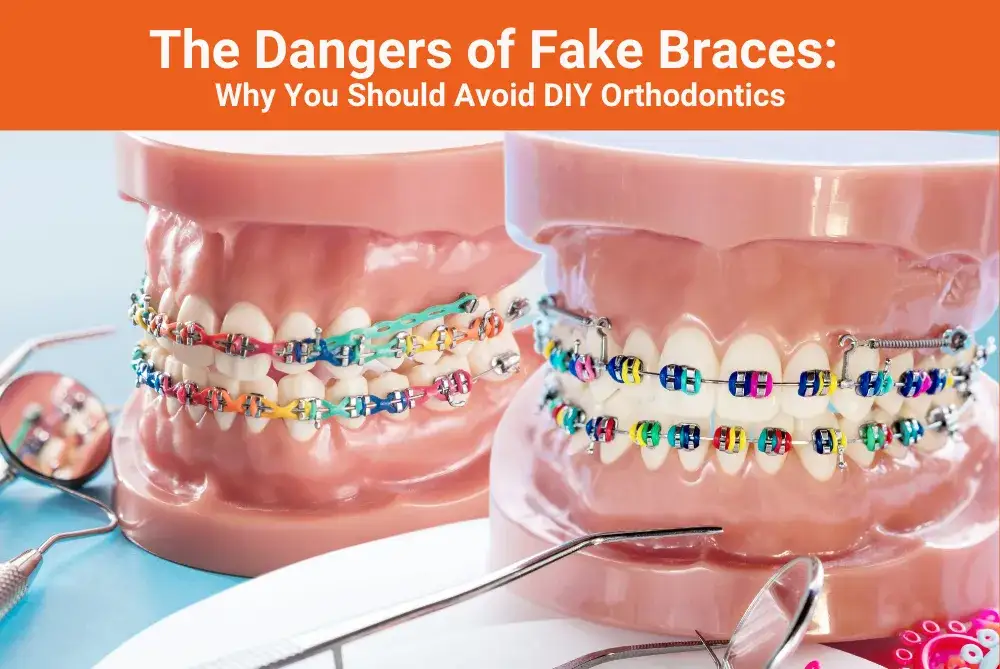 Fake braces: Jak zrobić i dlaczego to zły pomysł?