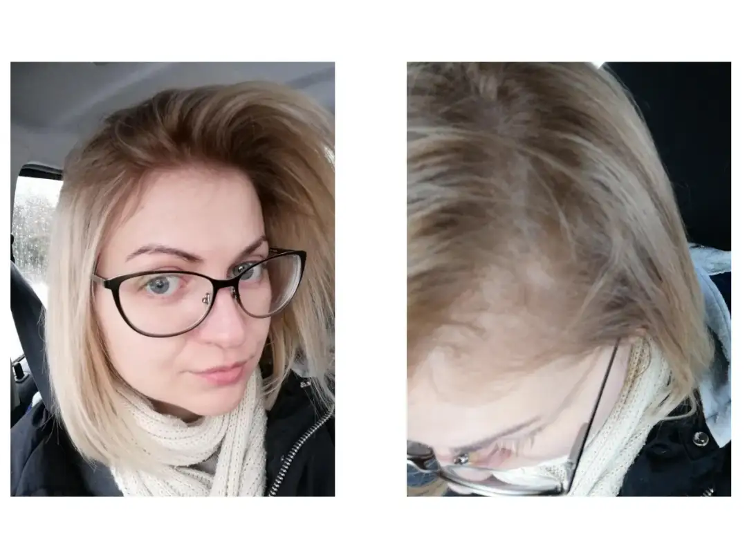 Farba do włosów nie chwyta? Oto dlaczego i jak to naprawić!