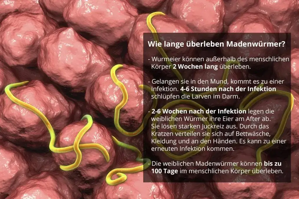 Madenwürmer Symptome: So erkennen Sie die Anzeichen rechtzeitig