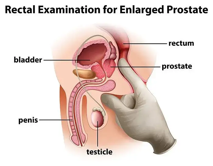 Masaż prostaty: Instrukcja dla zdrowia i przyjemności. Jak zacząć?