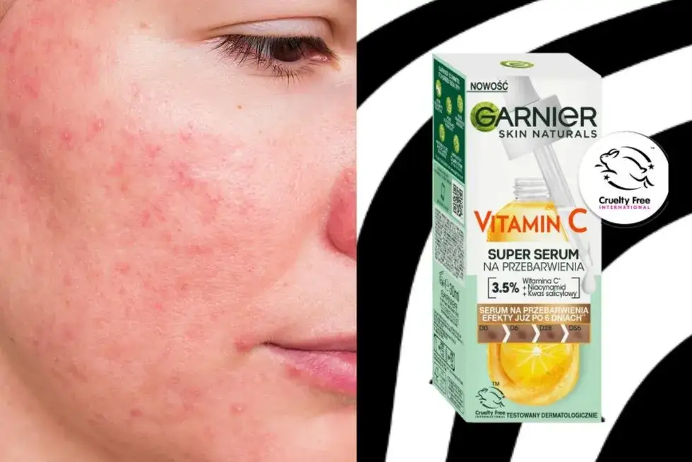 Co daje serum z witaminą C? Rozjaśnij przebarwienia, ujędrnij skórę!