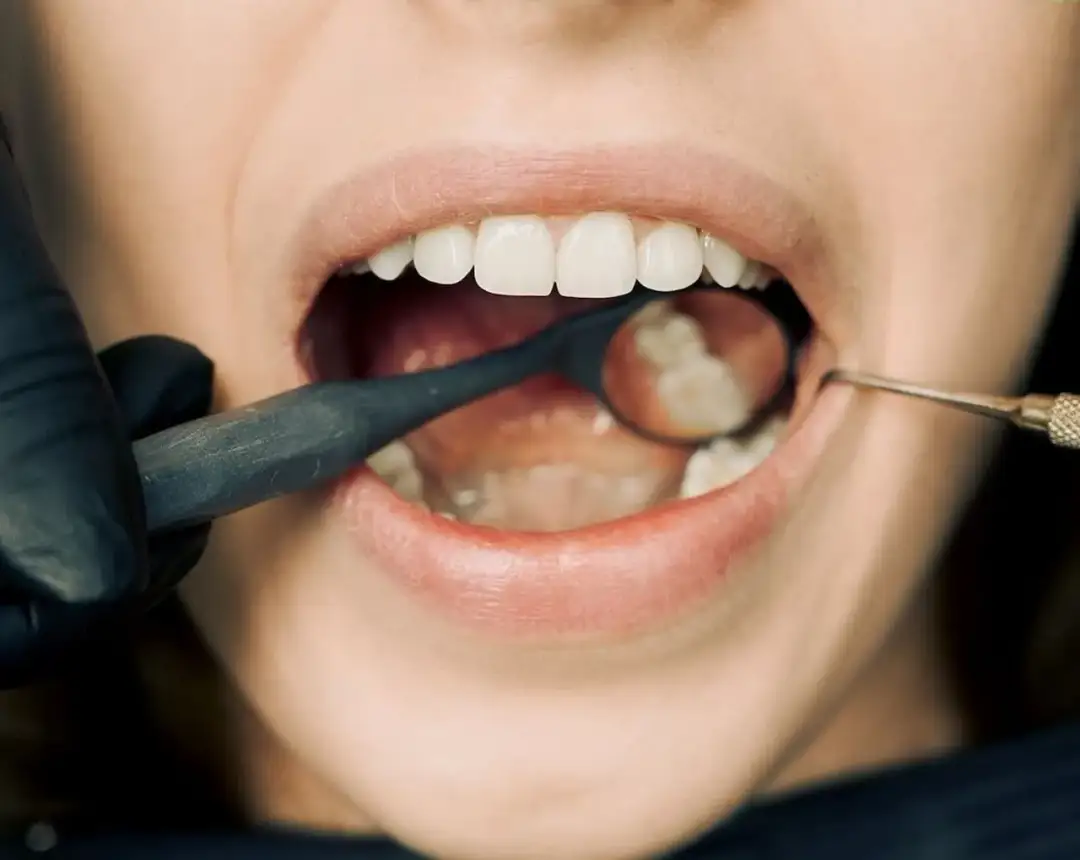 Antybiotyk na ząb z ropą: Co działa i kiedy do dentysty?