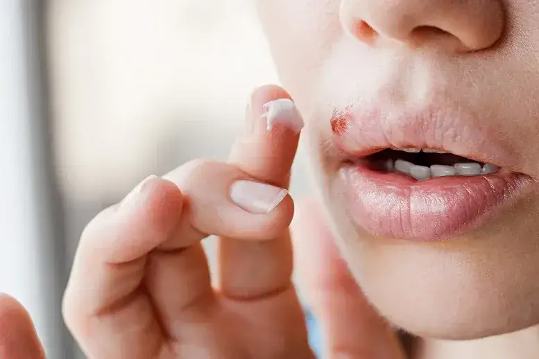 Czy z zimnem można iść do dentysty? Ryzyko i ważne informacje