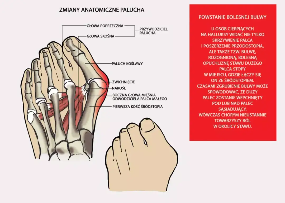 Duży palec u stopy: funkcje, problemy i jak o niego dbać