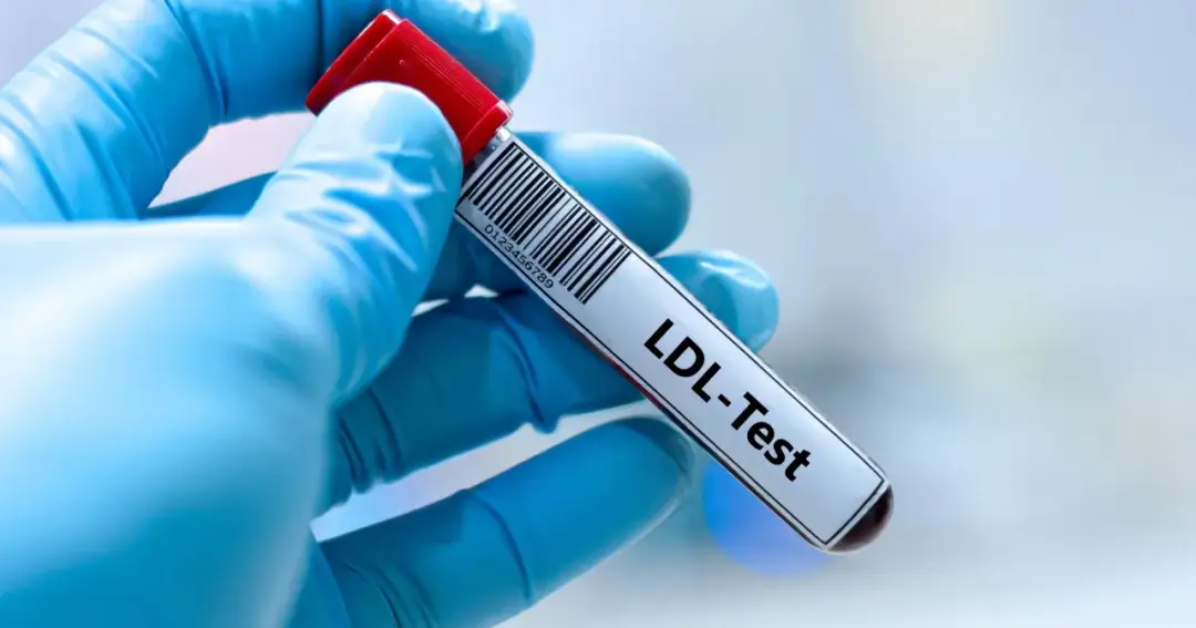 Podwyższony cholesterol LDL nie boli - Jak go skutecznie obniżyć?