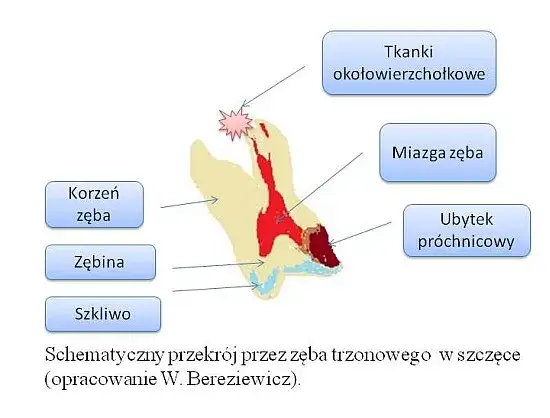 Nagły ból zęba? Obowiązek dentysty i Twoje prawa!
