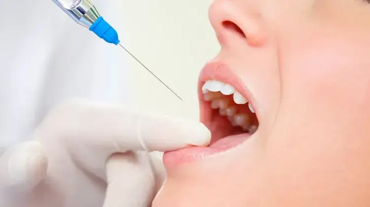 Znieczulenie u dentysty: Koniec z bólem? Sprawdź nowoczesne metody!
