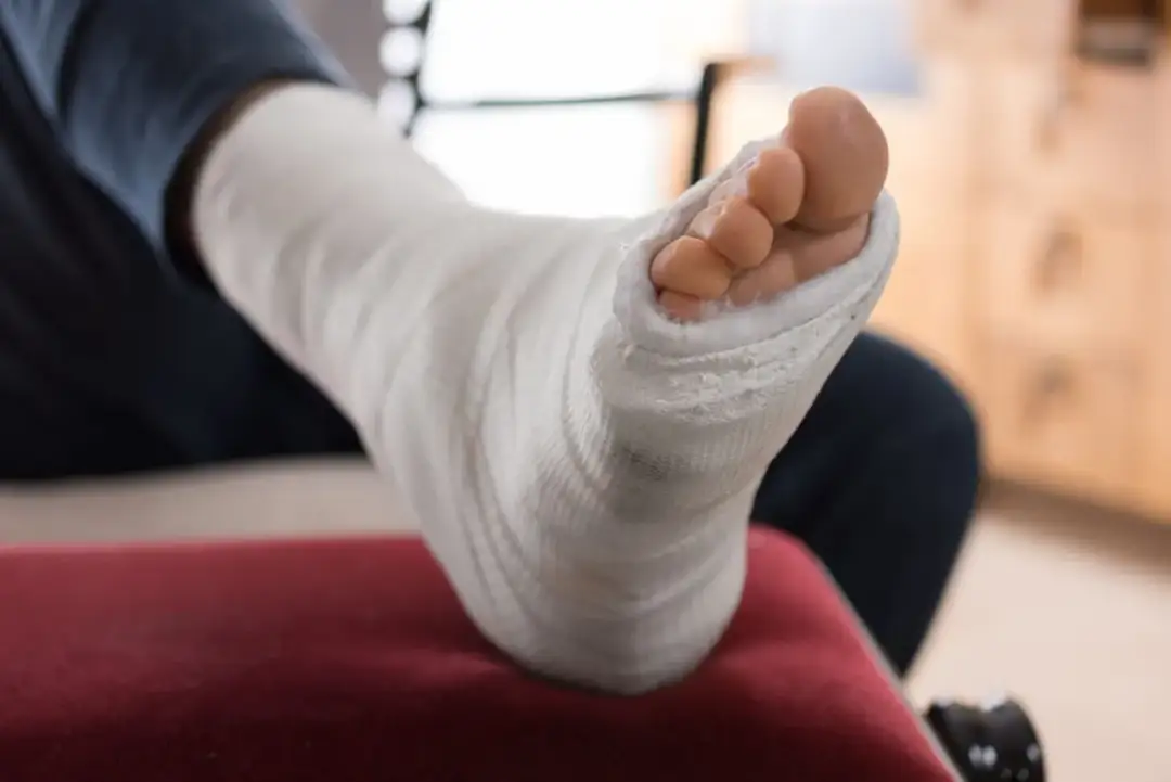Ile trwa rehabilitacja po złamaniu kostki bocznej? Poznaj szczegóły
