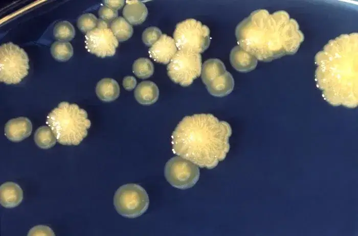 Enterobacter cloacae: Częste objawy i leczenie infekcji
