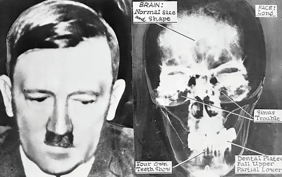 Kiedy zmarł Hitler? Zaskakujące okoliczności jego śmierci