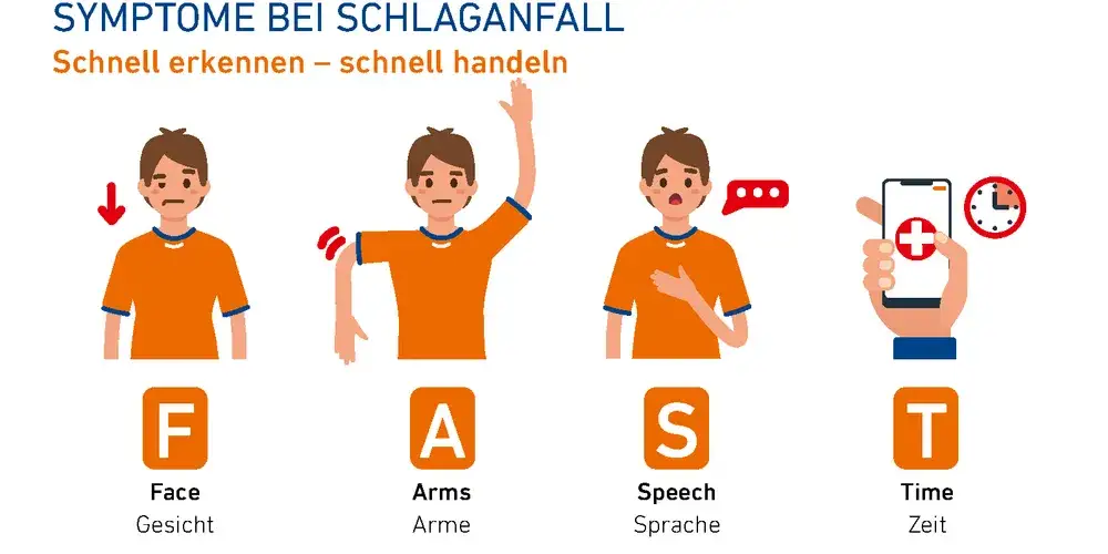 Apoplexie Symptome: Erkennen Sie die alarmierenden Anzeichen sofort