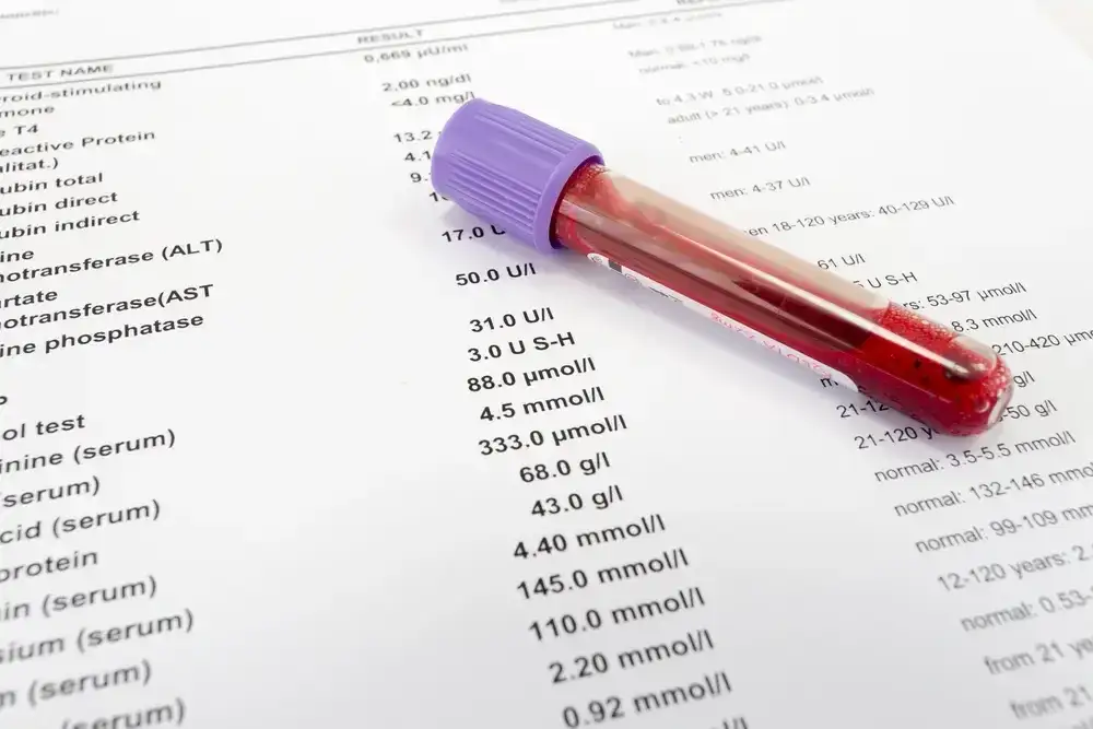 Jak odczytać wyniki badań laboratoryjnych: kompletny poradnik pacjenta