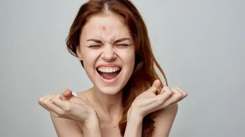 Jak pozbyć się pryszcza w jedną noc? Sprawdzone metody S.O.S.