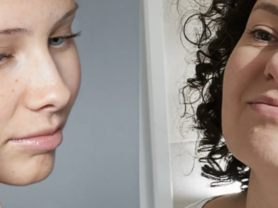 Jak wygląda cera naczynkowa i jak skutecznie o nią dbać?