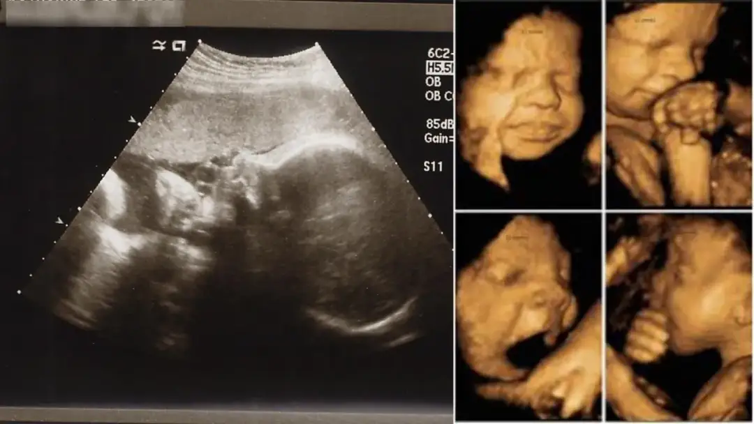 33 tydzień ciąży ból brzucha jak na okres – co może to oznaczać?