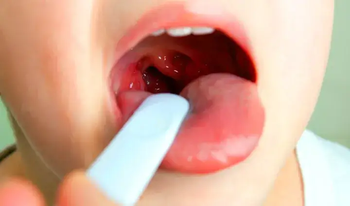 Objawy bólu gardła u niemowlaka – jak je rozpoznać i złagodzić ból