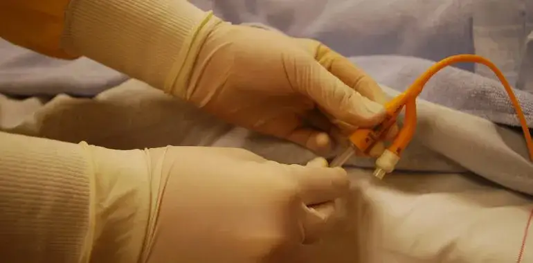 Zakładanie cewnika u mężczyzn: co warto wiedzieć o bólu i dyskomforcie