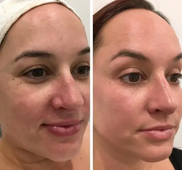 Gdzie kupić deep phyto peeling? Sprawdź najlepsze opcje i ceny