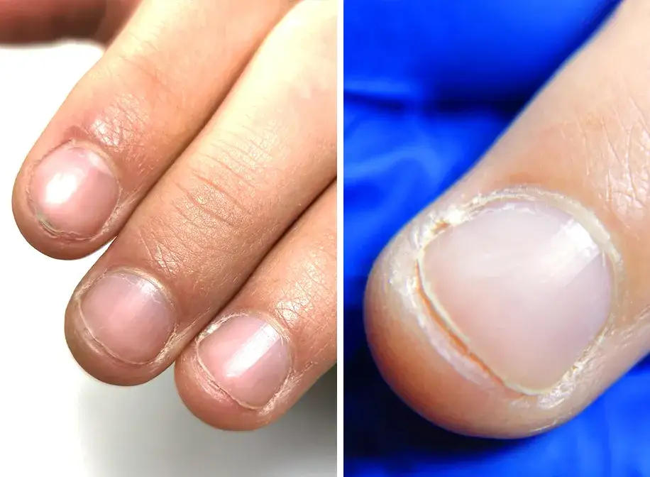 Przedłużanie obgryzionych paznokci: Jak odzyskać piękny wygląd?