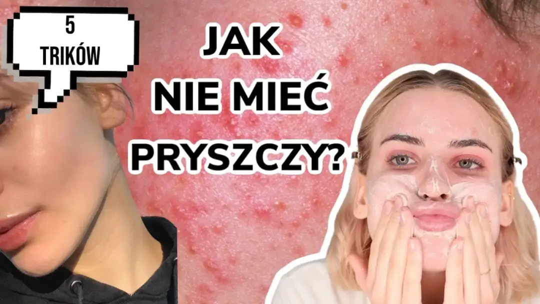 Gładka cera bez pryszczy? Odkryj sekrety eksperta!