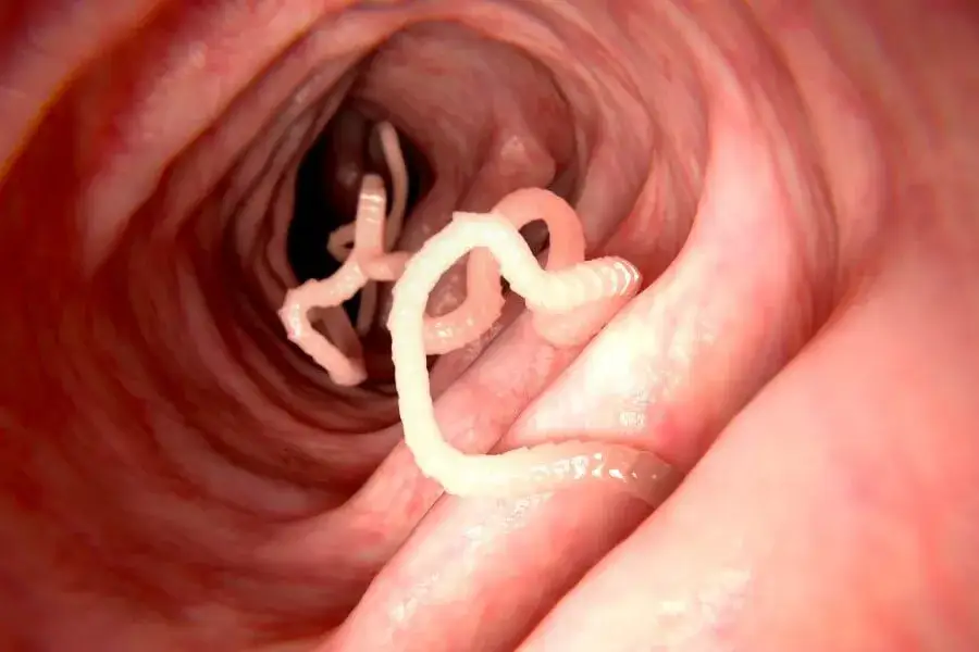 Jakie leki na pasożyty u człowieka: skuteczne metody leczenia i objawy